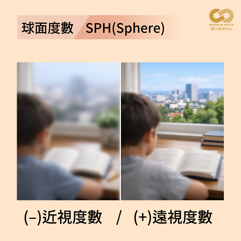 看懂驗光單其實沒那麼難